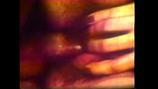 Nurses Attend to the Patient