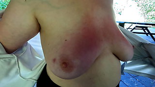 Red and swollen tits at bbq place